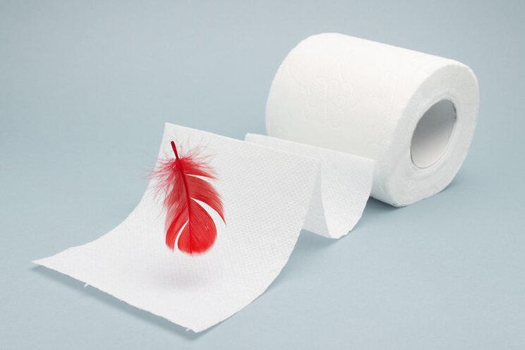 Blood on hygiene paper is a sign of hemorrhoids